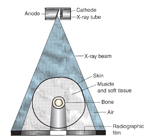 x-ray absorption