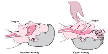 On Field Sports Injury Assessment And Treatment