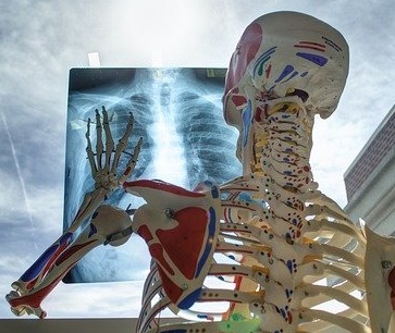 Radiography_(x-ray)